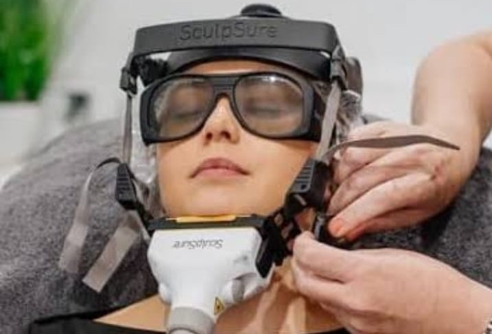 SculpSure